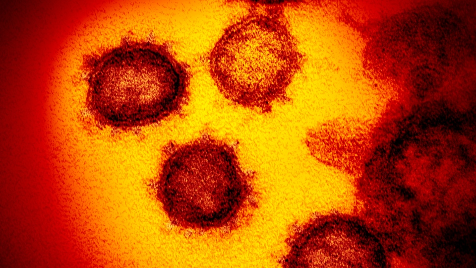 مسؤولو الصحة في أونتاريو: أنباء عن وجود حالة إصابة جديدة بفيروس كورونا في تورونتو