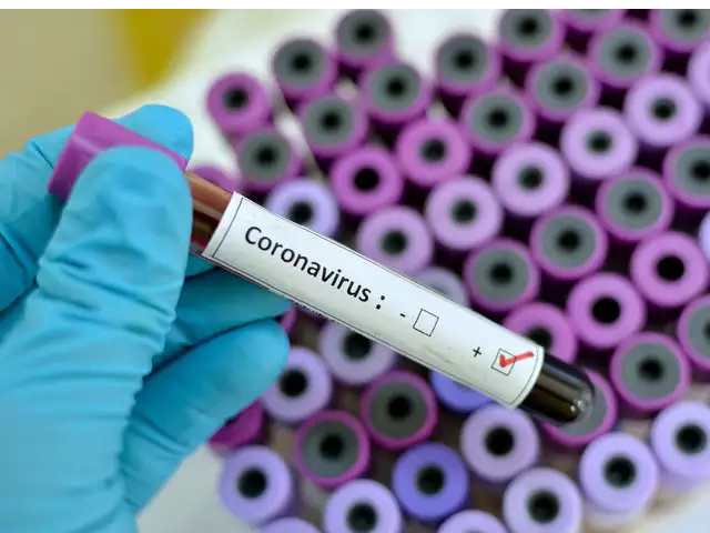 خبراء: فيروس كورونا قد يصيب 35 إلى 70 في المائة من الكنديين