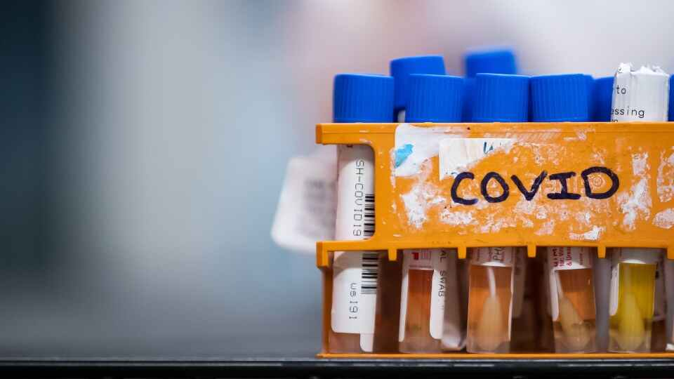 وزارة الصحة الكندية توافق على أول تجربة سريرية لتطوير لقاح خاص بفيروس كورونا