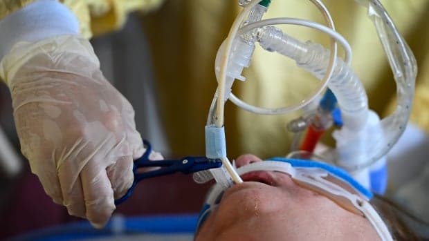 "سنختار من يستحق فرصة للبقاء على قيد الحياة"...أطباء أونتاريو يواجهون قرارات صعبة