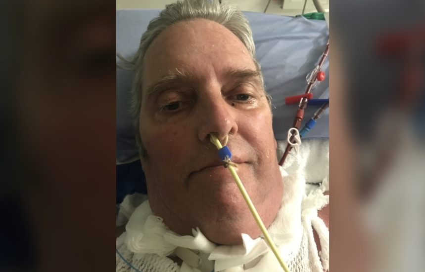 رجل من إدمنتون يخسر 8 من أصابعه بعد قضائه 10 أشهر في المستشفى بسبب الإصابة بكورونا