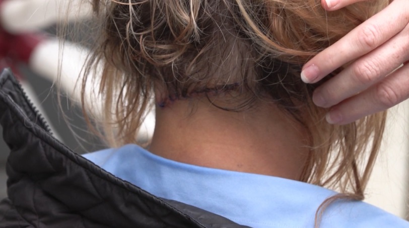 إصابة امرأة في رقبتها بساطور بعدما هاجمها شخص بدون سبب في فانكوفر