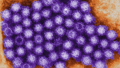 Norovirus التهاب المعدة والأمعاء