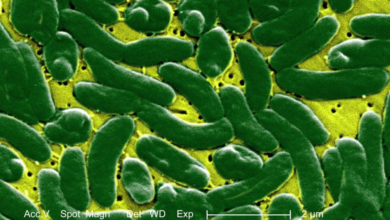 بكتيريا Vibrio vulnificus