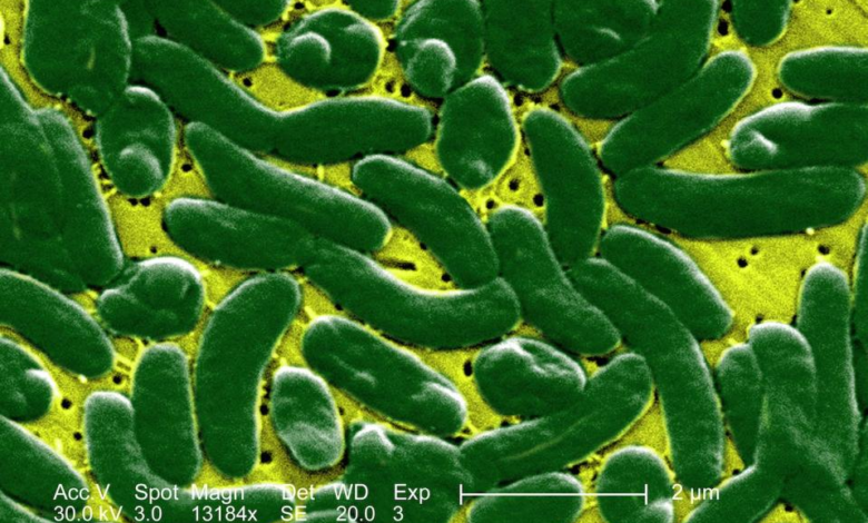 بكتيريا Vibrio vulnificus