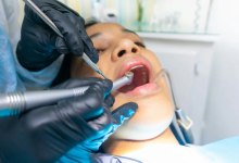 خطة رعاية الأسنان الكندية الجديدة